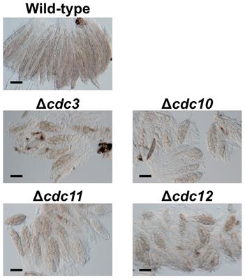 Meiotic Silencing in Dothideomycetous Bipolaris maydis